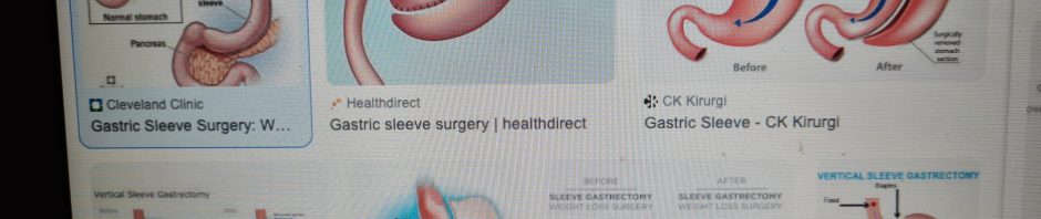 Hur går en gastric sleeve operation till och hur börjar man äta efter detta ingrepp?