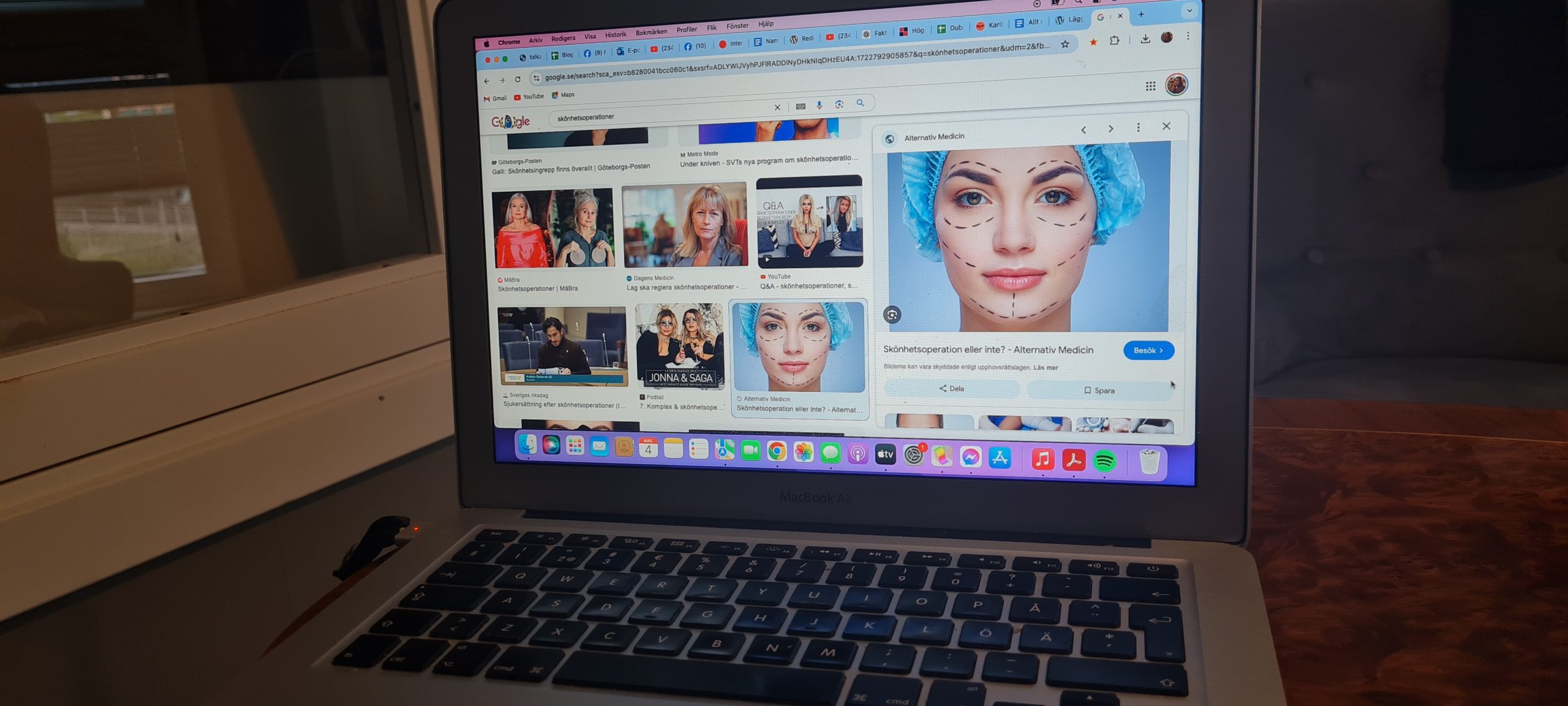 Journaler hos en plastikkirurg